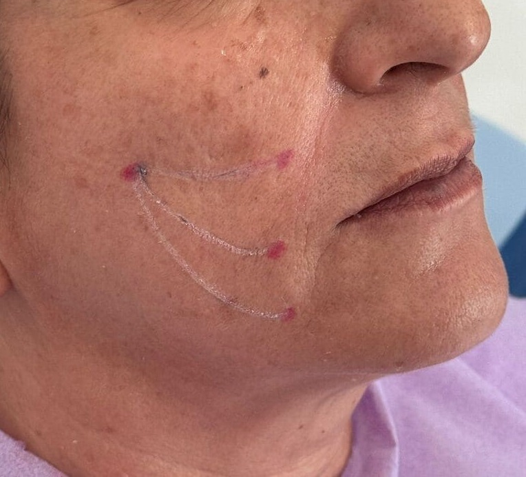 Estetica del viso - Dentista Siracusa